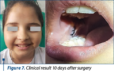 Figure 7. Clinical result 10 days after surgery