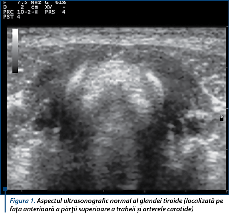 Aspectul ultrasonografic normal al glandei tiroide