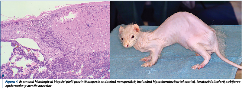  Examenul histologic al biopsiei pielii prezintă alopecie endocrină nonspecifică, incluzând hiperche