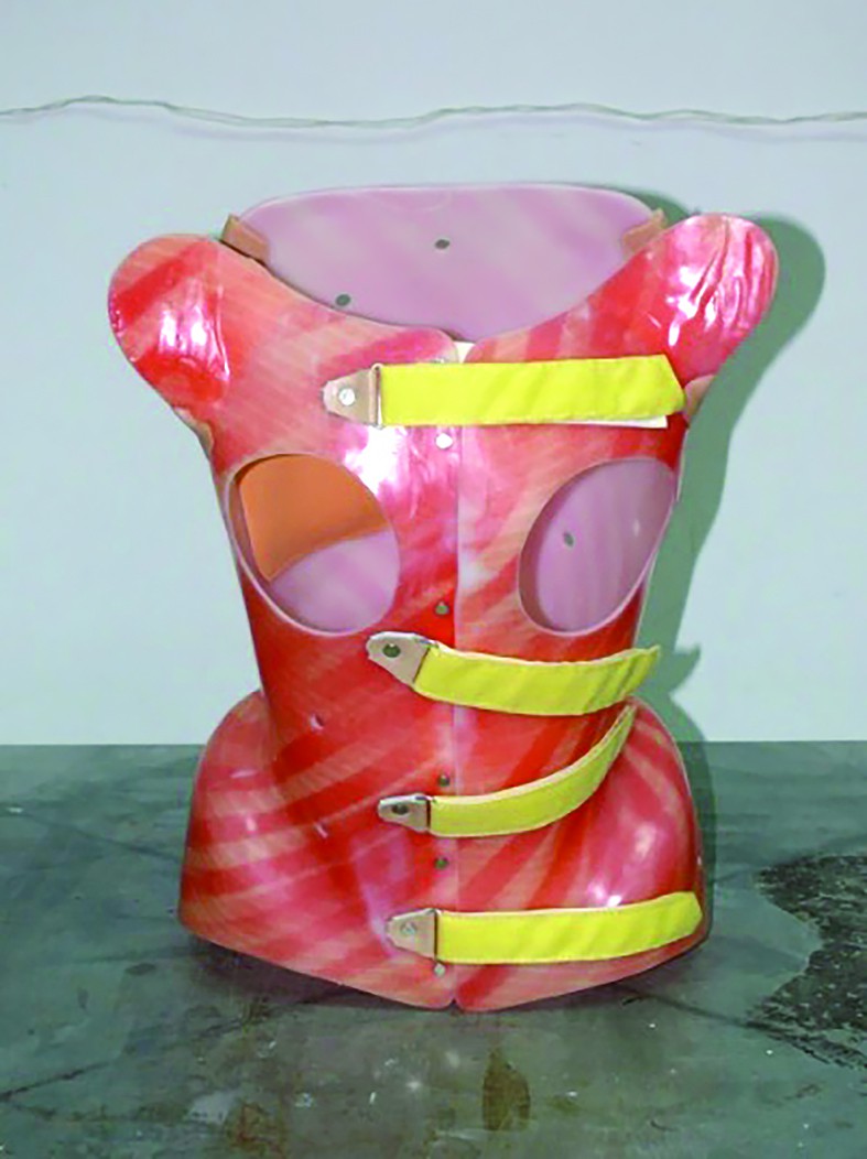 Figure 3. Cheneau corset