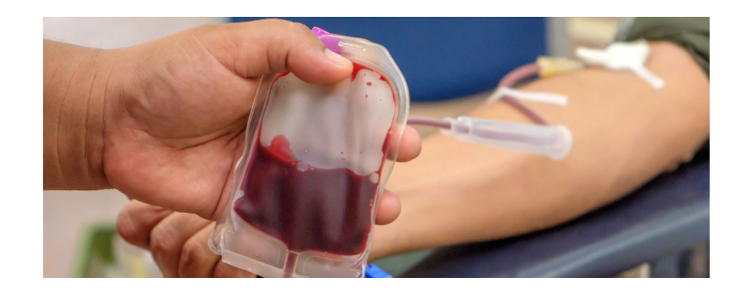 De ce nu poți dona sânge pentru varice
