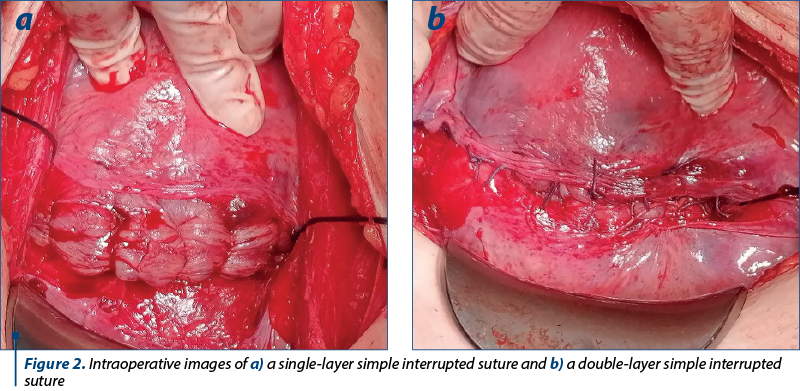 Figure 2. Intraoperative images of a) a single-layer simple interrupted suture and b) a double-layer simple interrupted suture
