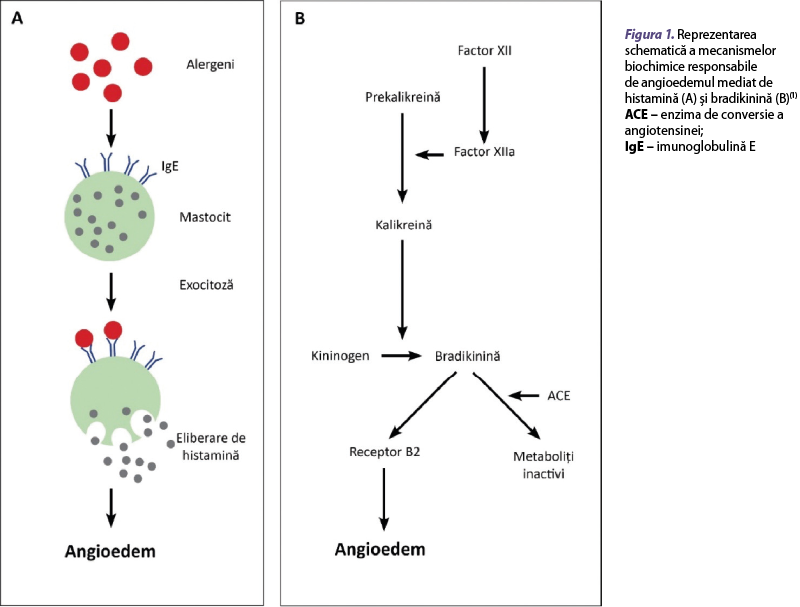 Figura 1. Reprezentarea schematică a mecanismelor biochimice responsabile de angioedemul mediat de histamină (A) şi bradikinină (B)
