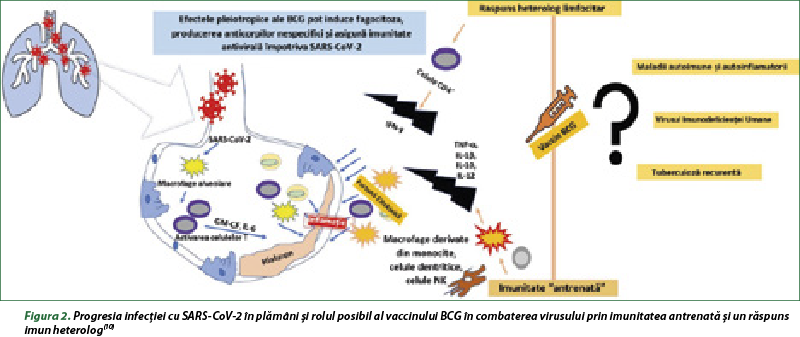 Figura 2. Progresia infecţiei cu SARS-CoV-2 în plămâni şi rolul posibil al vaccinului BCG în combaterea virusului prin imunitatea antrenată şi un răspuns imun heterolog(10)