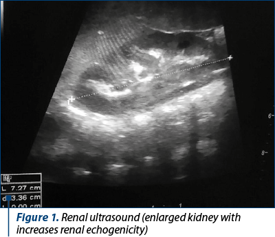 Figure 1. Renal ultrasound (enlarged kidney with increases renal echogenicity)