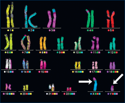 Figura 5. Sexul cromozomial