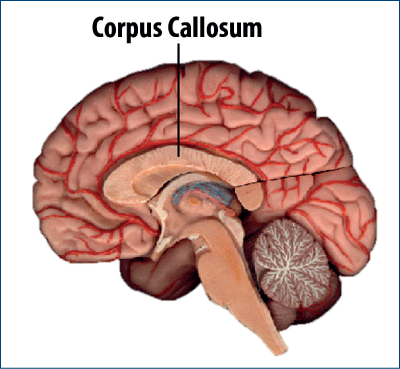 Figura 14. Poziţionarea corpus calos în creier