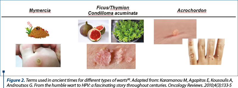 Figure 2. Terms used in ancient times for different types of warts(4). Adapted from: Karamanou M, Agapitos E, Kousoulis A, Androutsos G. From the humble wart to HPV: a fascinating story throughout centuries. Oncology Reviews. 2010;4(3):133-5