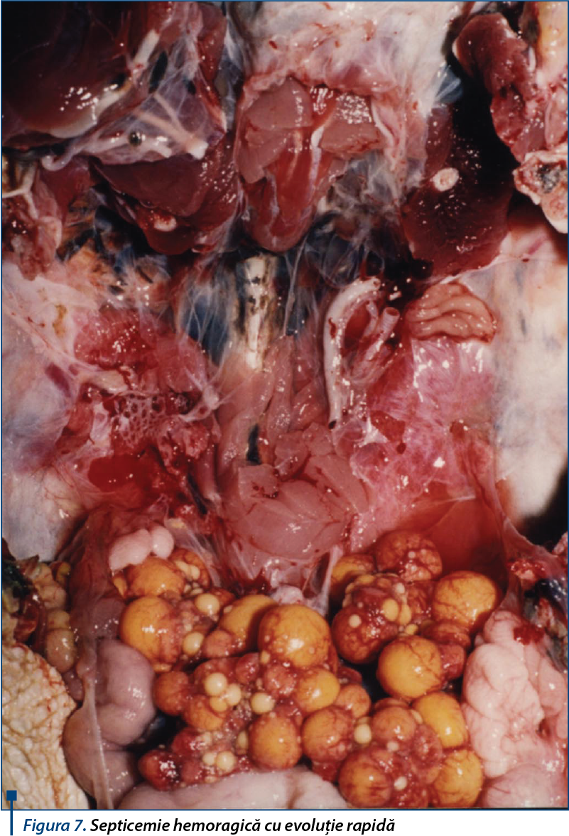 Figura 7. Septicemie hemoragică cu evoluție rapidă