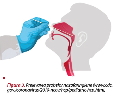 Figura 3. Prelevarea probelor nazo­faringiene (www.cdc.gov./coronavirus/2019-ncov/hcp/pediatric-hcp.html)