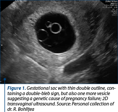 Figure 1. Gestational sac with thin double outline, con­taining a double-bleb sign, but also one more vesicle suggesting a genetic cause of pregnancy failure; 2D transvaginal ultrasound. Source: Personal collection of dr. R. Bohîlţea  