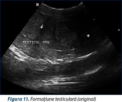 Figura 11. Formaţiune testiculară (original)