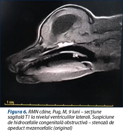 Figura 6. RMN câine, Pug, M, 9 luni – secţiune sagitală T1 la nivelul ventriculilor laterali. Suspiciune de hidrocefalie congenitală obstructivă – stenoză de apeduct mezencefalic (original)