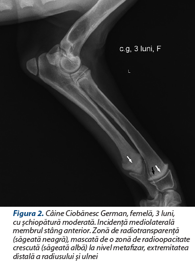 Figura 2. Câine Ciobănesc German, femelă, 3 luni, cu şchiopătură moderată. Incidenţă mediolaterală membrul stâng anterior. Zonă de radiotransparenţă (săgeată neagră), mascată de o zonă de radioopacitate crescută (săgeată albă) la nivel metafizar, extremitatea distală a radiusului şi ulnei 