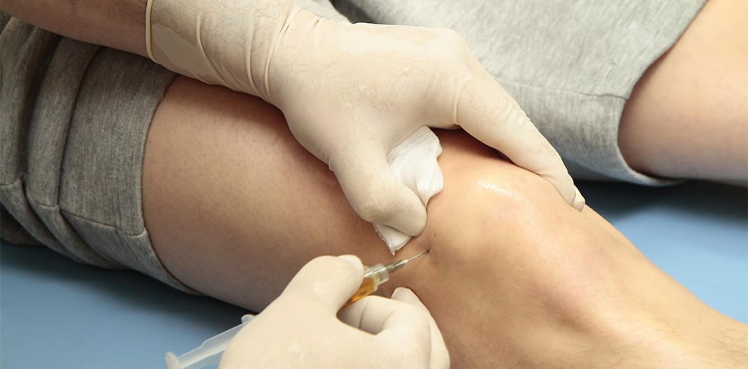 Cum se poate identifica artrita la genunchi tratarea articulațiilor gleznei
