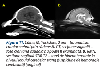 Figura 11. Câine, M, Yorkshire, 2 ani – traumatism craniocerebral prin cădere: A. CT, secţiune sagitală – fosa craniană caudală nu poate fi examinată; B. RMN, secţiune sagitală STIR T2 – zonã de hiperintensitate la nivelul lobului cerebelar stâng (suspiciune de hemoragie cerebelară) (original)