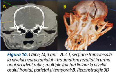 Figura 10. Câine, M, 3 ani – A. CT, secţiune transversală la nivelul neurocraniului – traumatism rezultat în urma unui accident rutier, multiple fracturi liniare la nivelul osului frontal, parietal şi temporal; B. Reconstrucţie 3D