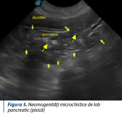 Figura 5. Neomogenităţi microchistice de lob pancreatic (pisică)