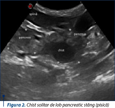 Figura 2. Chist solitar de lob pancreatic stâng (pisică)
