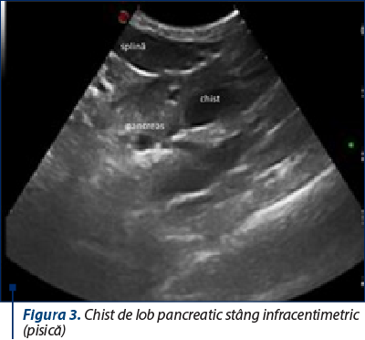 Figura 3. Chist de lob pancreatic stâng infracentimetric (pisică) 