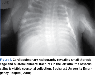 Figure 1. Cardiopulmonary radiography revealing small thoracic cage and bilateral humeral fractures in the left arm; the osseous callus is visible (personal collection, Bucharest University Emergency Hospital, 2018)