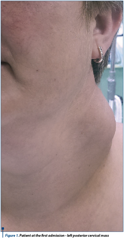 Figure 1. Patient at the first admission - left posterior cervical mass