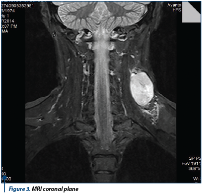 Figure 3. MRI coronal plane 