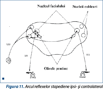 Figura 11. Arcul reflexelor stapediene ipsi- şi contralateral