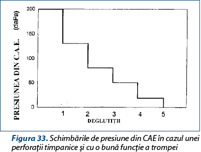 Figura 33. Schimbările de presiune din CAE în cazul unei perforaţii timpanice şi cu o bună funcţie a trompei