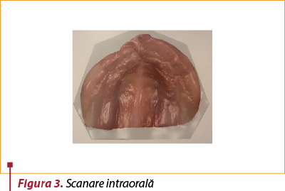 Figura 3. Scanare intraorală