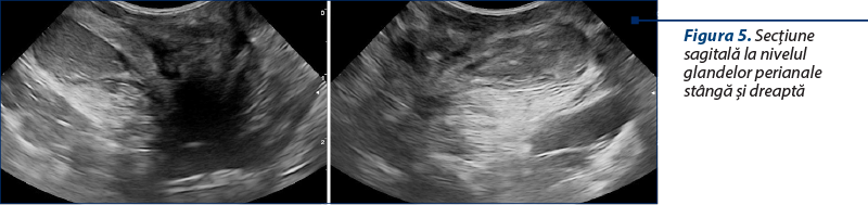 Figura 5. Secţiune sagitală la nivelul glandelor perianale stângă şi dreaptă