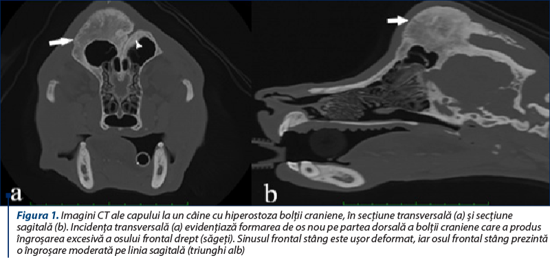 Figura 1. Imagini CT ale capului la un câine cu hiperostoza bolţii craniene, în secţiune transversală (a) şi secţiune sagitală (b). Incidenţa transversală (a) evidenţiază formarea de os nou pe partea dorsală a bolţii craniene care a produs îngroşarea excesivă a osului frontal drept (săgeţi). Sinusul frontal stâng este uşor deformat, iar osul frontal stâng prezintă o îngroşare moderată pe linia sagitală (triunghi alb)