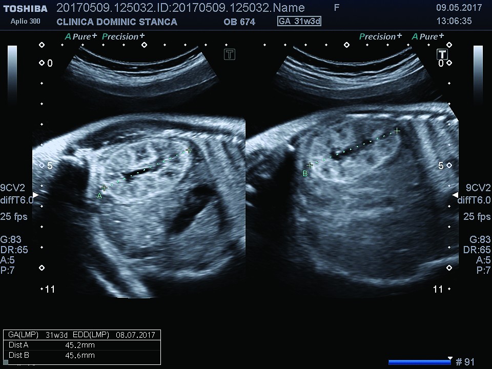 Figura 1. Evaluarea rinichilor în secţiune sagitală