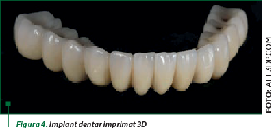 Figura 4. Implant dentar imprimat 3D
