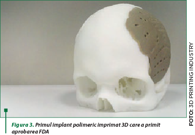 Figura 3. Primul implant polimeric imprimat 3D care a primit aprobarea FDA