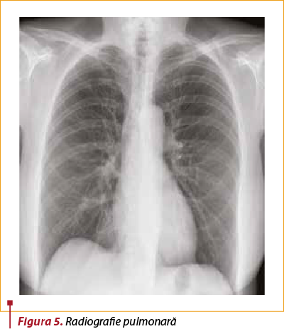 Figura 5. Radiografie pulmonară