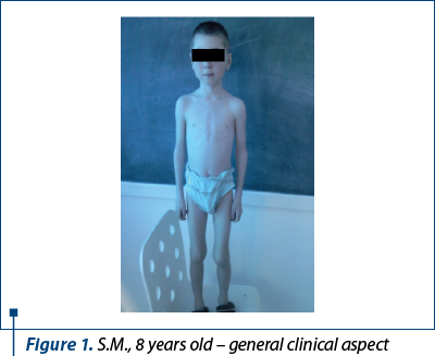 Figure 1. S.M., 8 years old – general clinical aspect