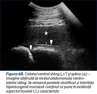 Figura 8B. Colonul ventral stâng („+”) şi splina (☆) – imagine obţinută la nivelul abdomenului ventro-lateral stâng. Se remarcă peretele stratificat şi interfaţa hiperecogenă mucoasă-conţinut ce pune în evidenţă aspectul boselat (△) caracteristic