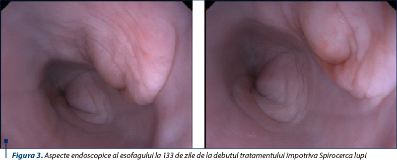 Figura 3. Aspecte endoscopice al esofagului la 133 de zile de la debutul tratamentului împotriva Spirocerca lupi