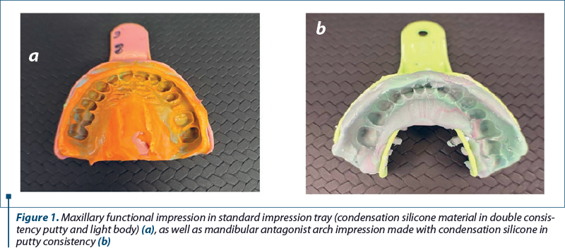 Figure 1. Maxillary functional impression in standard impression tray (condensation silicone material in double con­sis­tency putty and light body) (a), as well as mandibular antagonist arch impression made with condensation silicone in putty consistency (b)