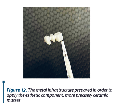 Figure 12. The metal infrastructure prepared in order to apply the esthetic component, more precisely ceramic masses