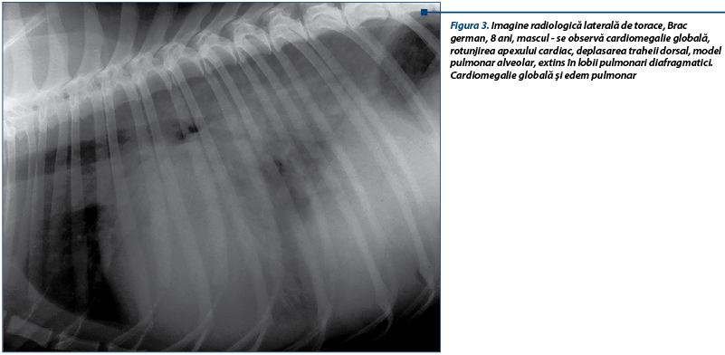 Figura 3. Imagine radiologică laterală de torace, Brac german