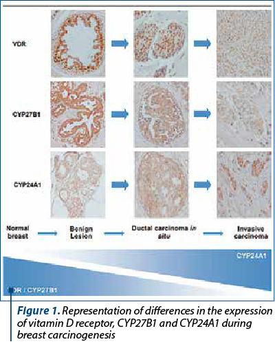 Figure 1. Representation of differences in the expression of vitamin D receptor, CYP27B1 and CYP24A1 during breast carcinogenesis