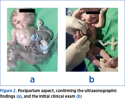 Figure 2. Postpartum aspect, confirming the ultrasonographic findings (a), and the initial clinical exam (b)