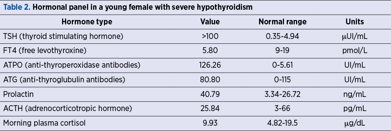 Table 2. Hormonal panel in a young female with severe hypothyroidism