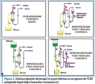 Figura 5. Schema tipurilor de terapii ce se pot efectua cu un aparat de TCSR (adaptată dup