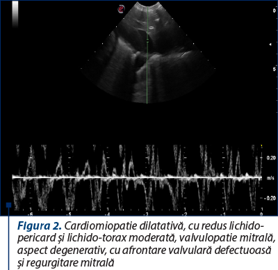 Figura 2. Cardiomiopatie dilatativă, cu redus lichido-pericard şi lichido-torax moderată, valvulopatie mitrală, aspect degenerativ, cu afrontare valvulară defectuoasă şi regurgitare mitrală