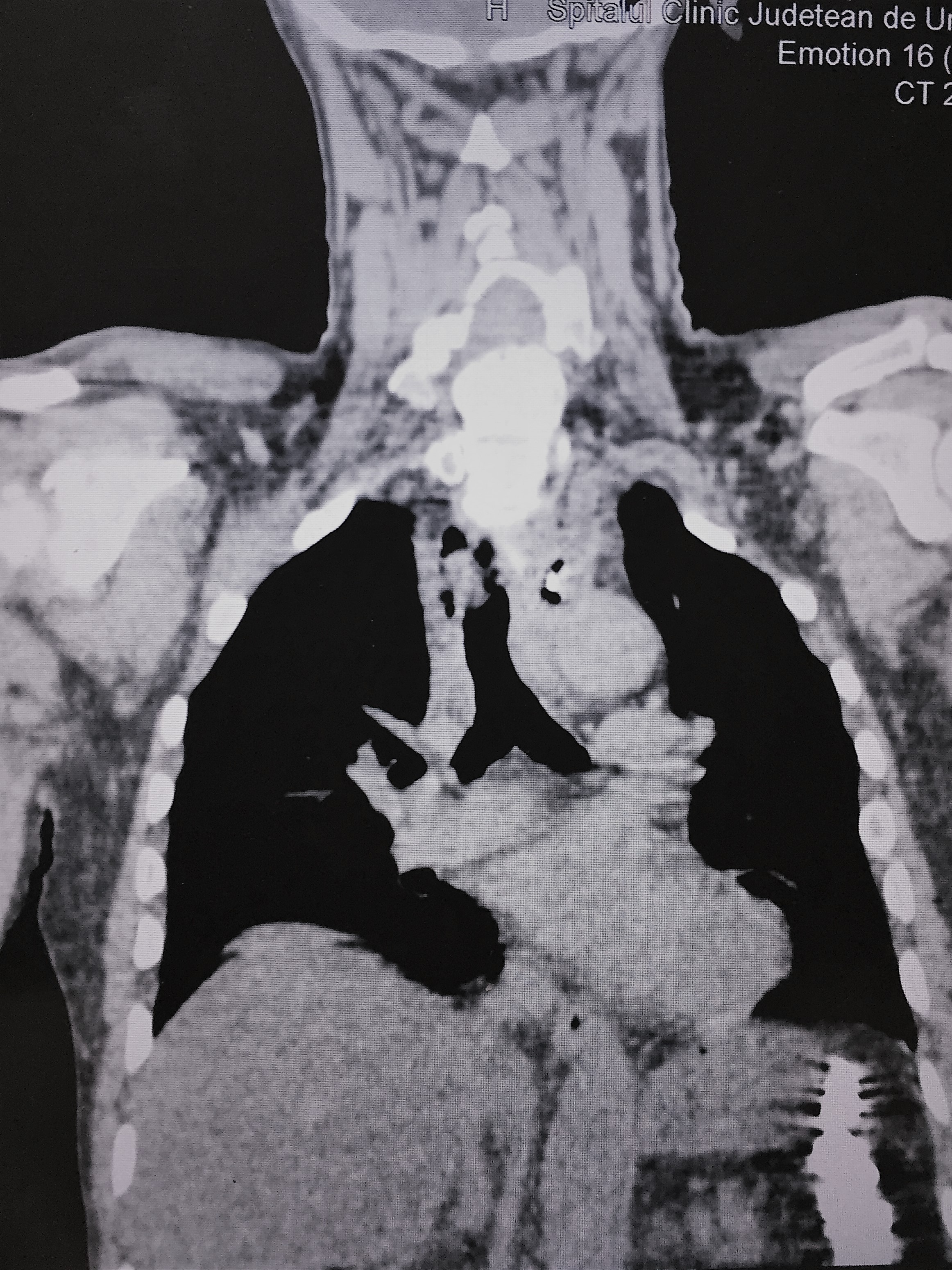 Figura 1. Imagini CT de gât și torace