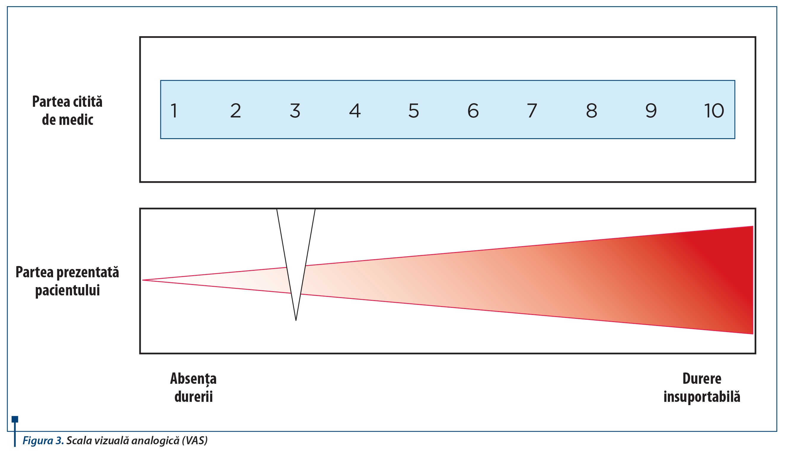Figura 3. Scala vizuală analogică (VAS)