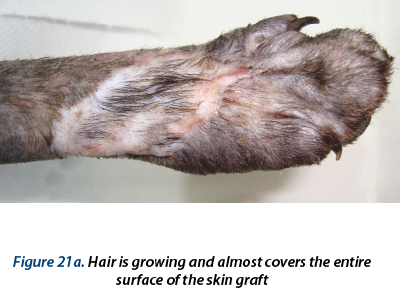Figure 21a. Hair is growing and almost covers the entire  surface of the skin graft 